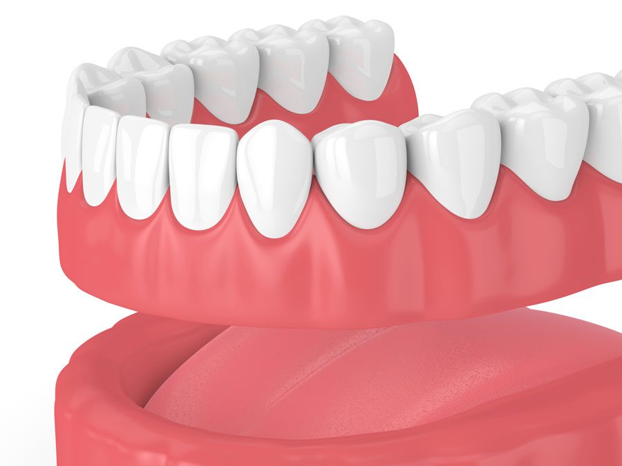 3D dental dentures rendering